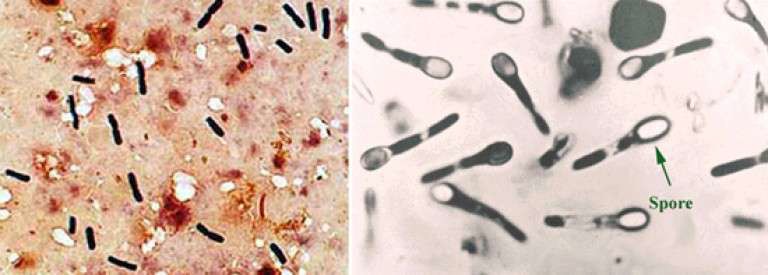 Морфология бактерий и спор Clostridium botulinum – возбудителей ботулизма
