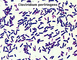 Морфология строения бактерий Clostridium perfringens